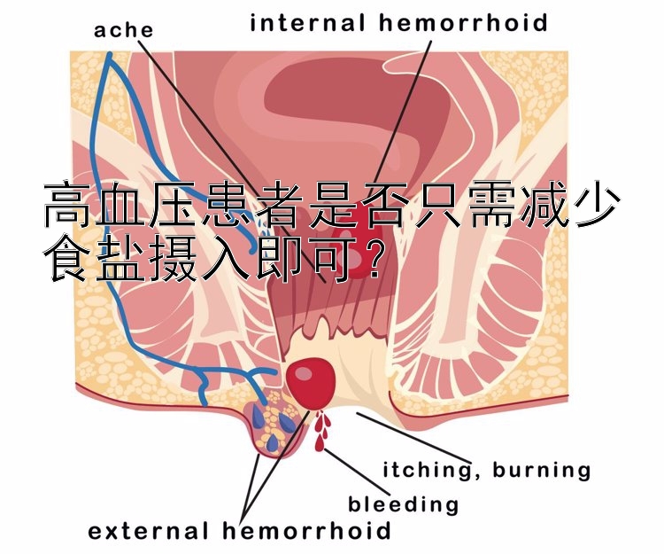 高血压患者是否只需减少食盐摄入即可？