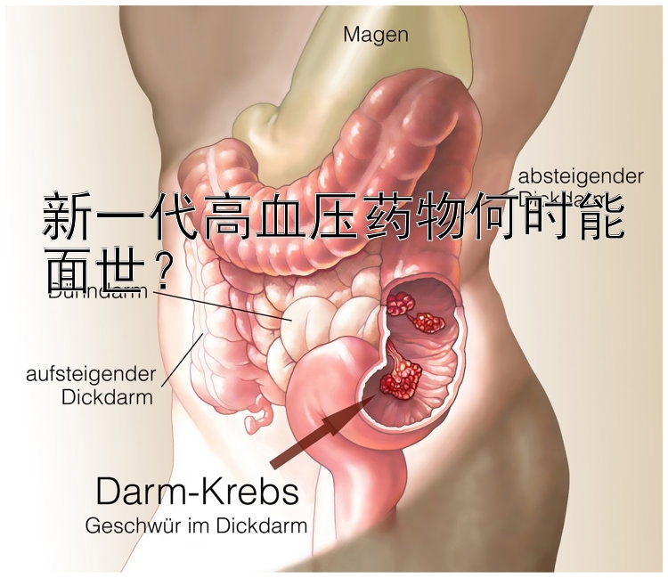 新一代高血压药物何时能面世？