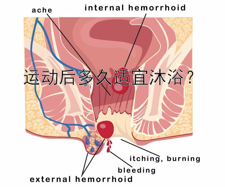 运动后多久适宜沐浴？