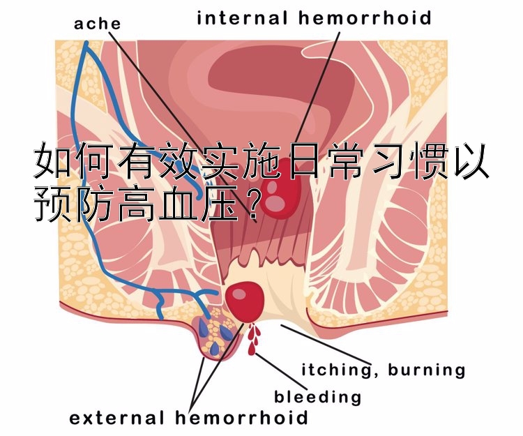 如何有效实施日常习惯以预防高血压？