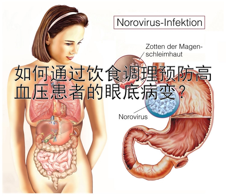 如何通过饮食调理预防高血压患者的眼底病变？