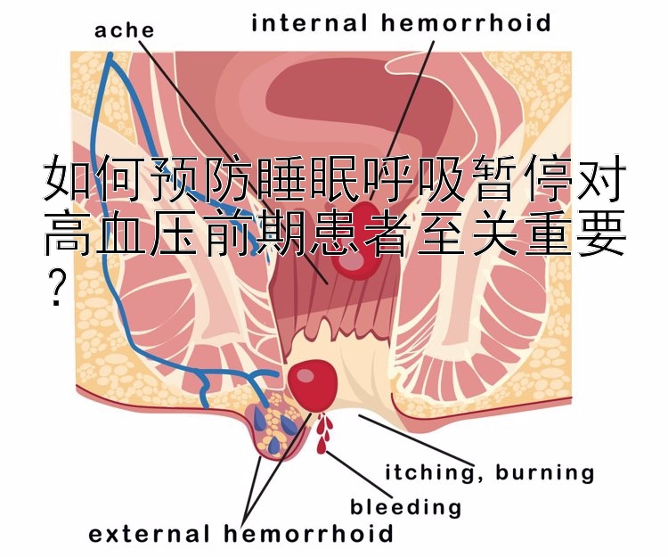 如何预防睡眠呼吸暂停对高血压前期患者至关重要？