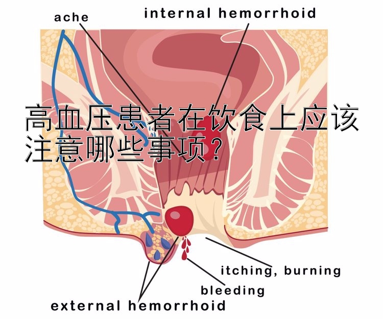 高血压患者在饮食上应该注意哪些事项？