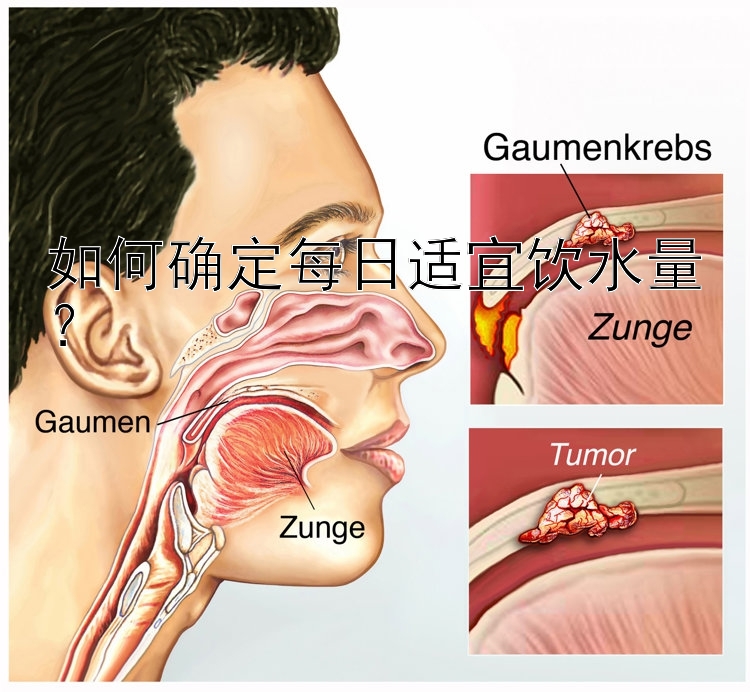 如何确定每日适宜饮水量？