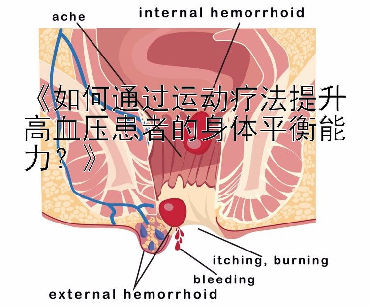 《如何通过运动疗法提升高血压患者的身体平衡能力？》