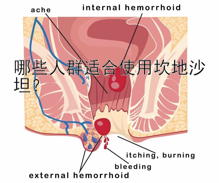 哪些人群适合使用坎地沙坦？