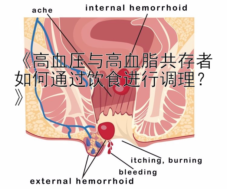 《高血压与高血脂共存者如何通过饮食进行调理？》