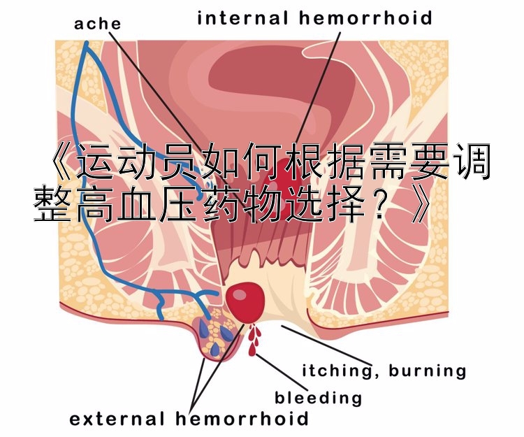 《运动员如何根据需要调整高血压药物选择？》