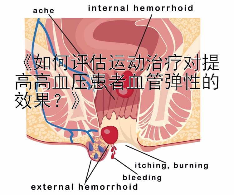 《如何评估运动治疗对提高高血压患者血管弹性的效果？》