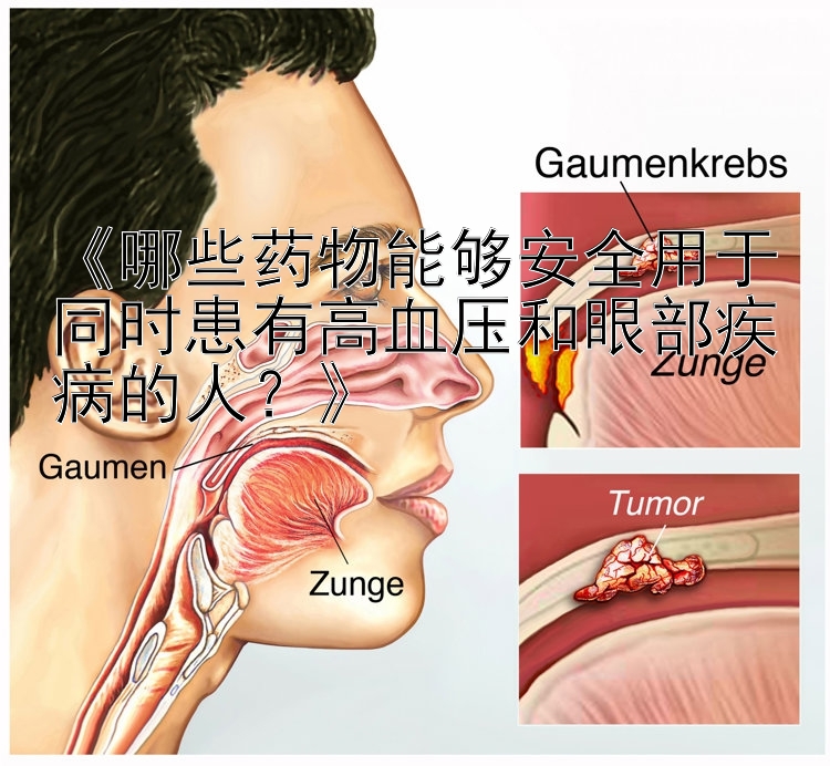 《哪些药物能够安全用于同时患有高血压和眼部疾病的人？》