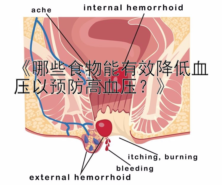 《哪些食物能有效降低血压以预防高血压？》