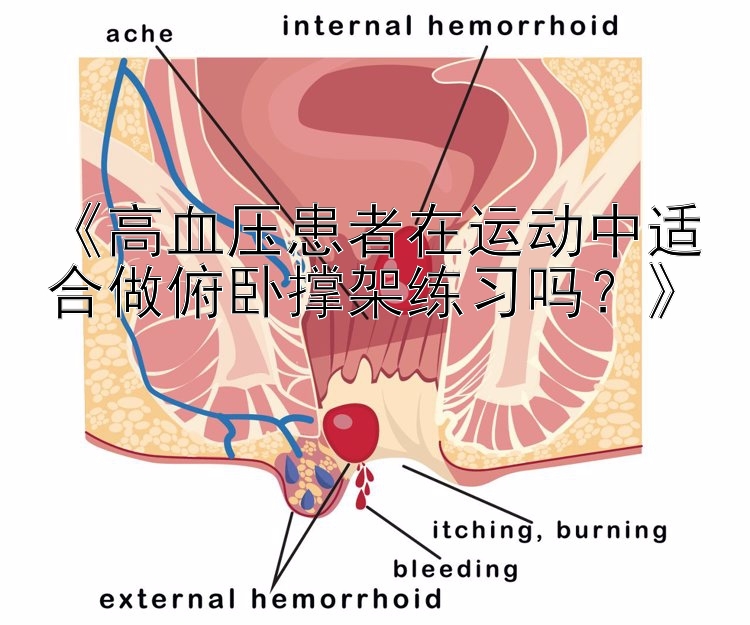 江西省11选5 《高血压患者在运动中适合做俯卧撑架练习吗？》