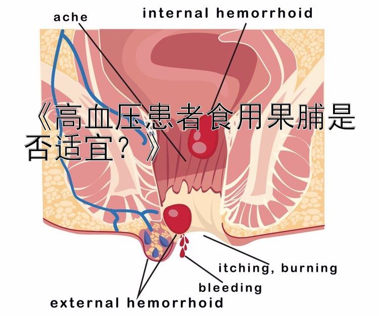 《高血压患者食用果脯是否适宜？》