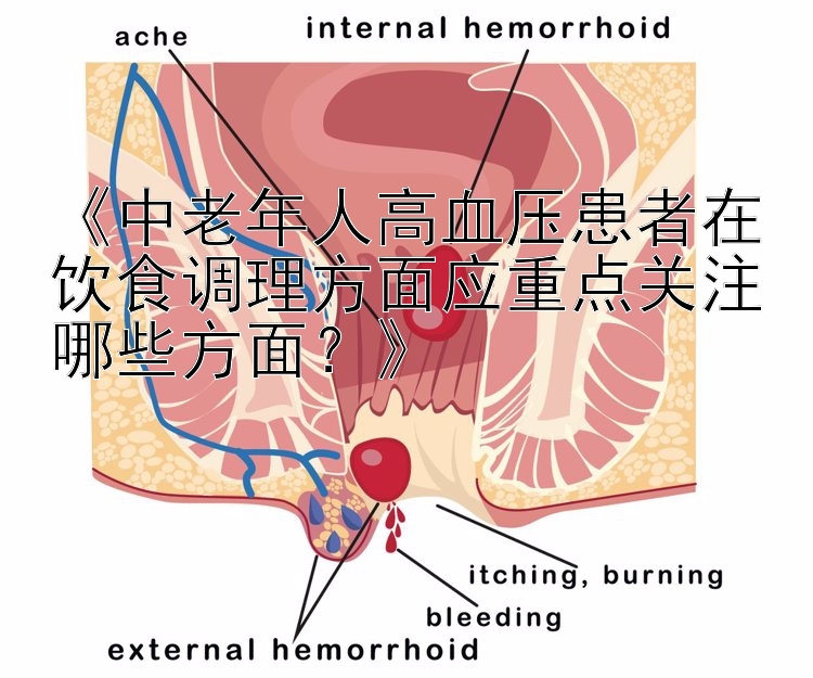 《中老年人高血压患者在饮食调理方面应重点关注哪些方面？》