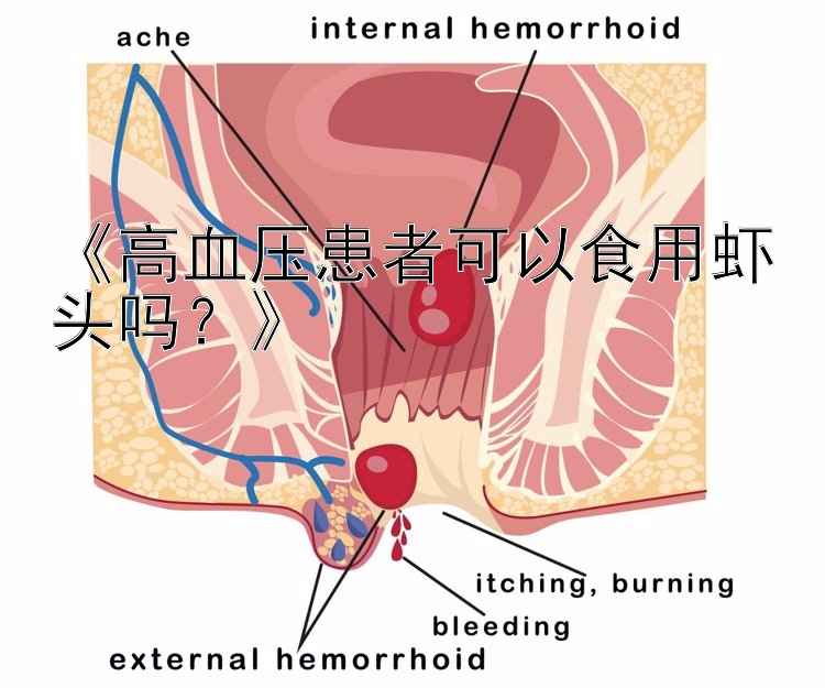 《高血压患者可以食用虾头吗？》